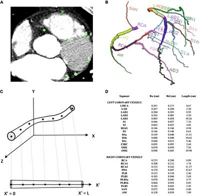 A predictive patient-specific computational model of coronary artery bypass grafts for potential use by cardiac surgeons to guide selection of graft configurations